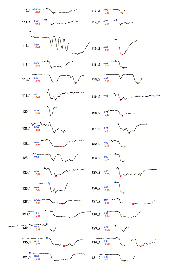 sparklines for cardiac fractional flow reserve